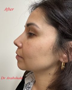 New CRP post op 2025