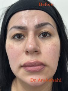 Before and After from Wade