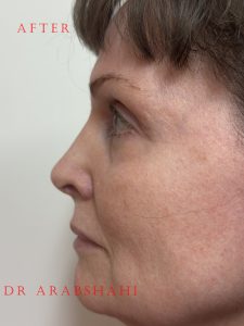 Clark Pre and Post 1