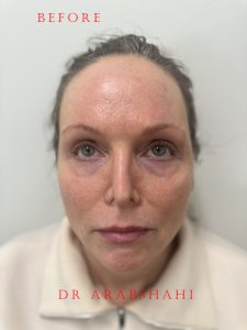 IMG 6632 from clozano